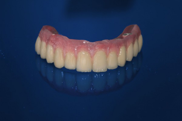 blue-denture