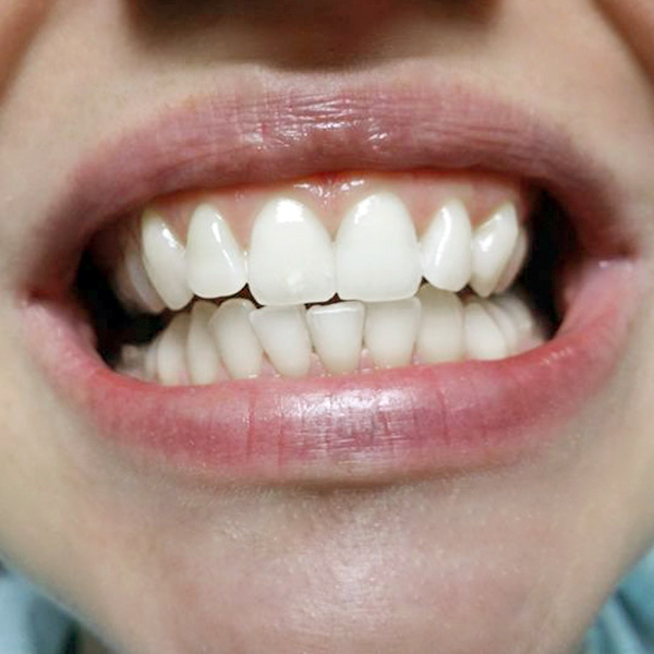 1-estetska-stomatologija